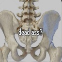 DeadAss Emote