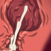 s_nut emote